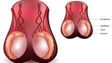 Erkek Yumurtalık Hastalıkları